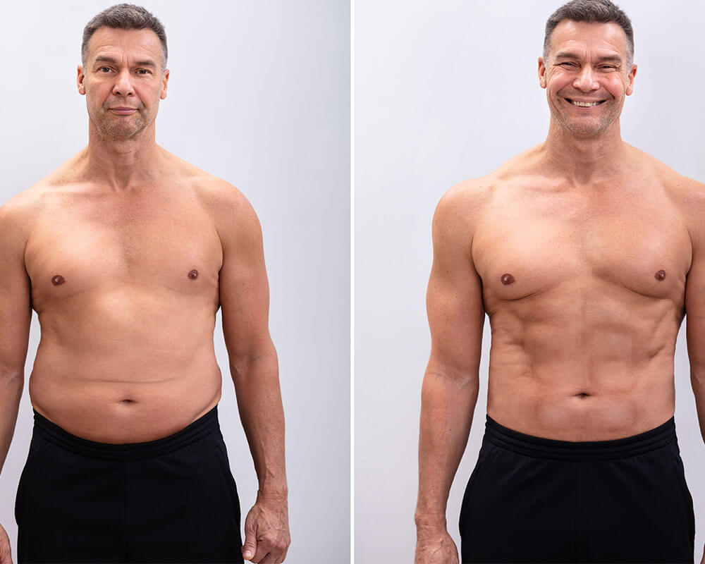 Phenocal - Befire After